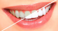 Teeth Whitening ›