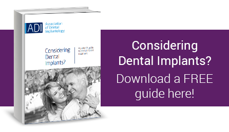 Dental implant guide