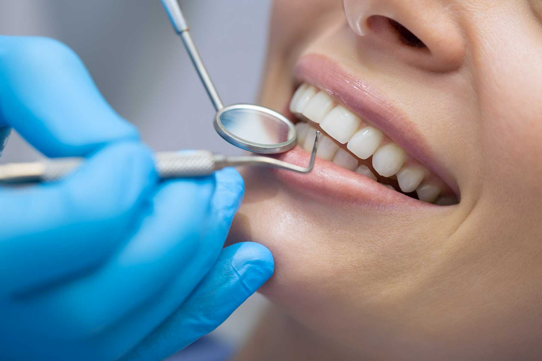 dental-check-up