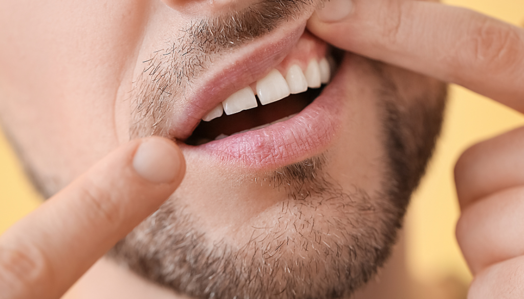 Gum-Disease-Dental-treatment