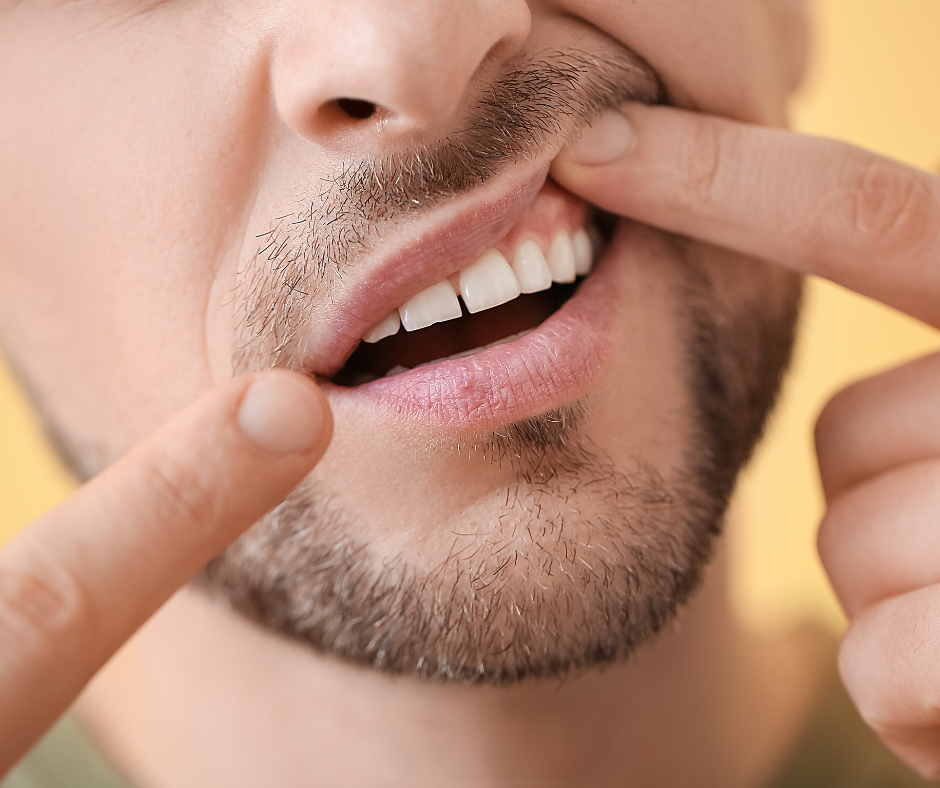 Gum-Disease-Dental-treatment