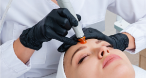 Cosmetic Facial Treatments