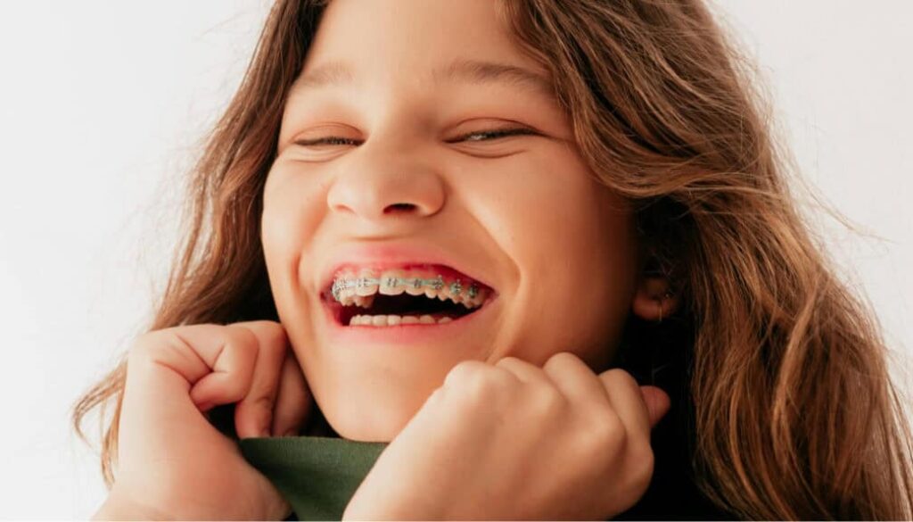How Long Does It Take to Put on Braces