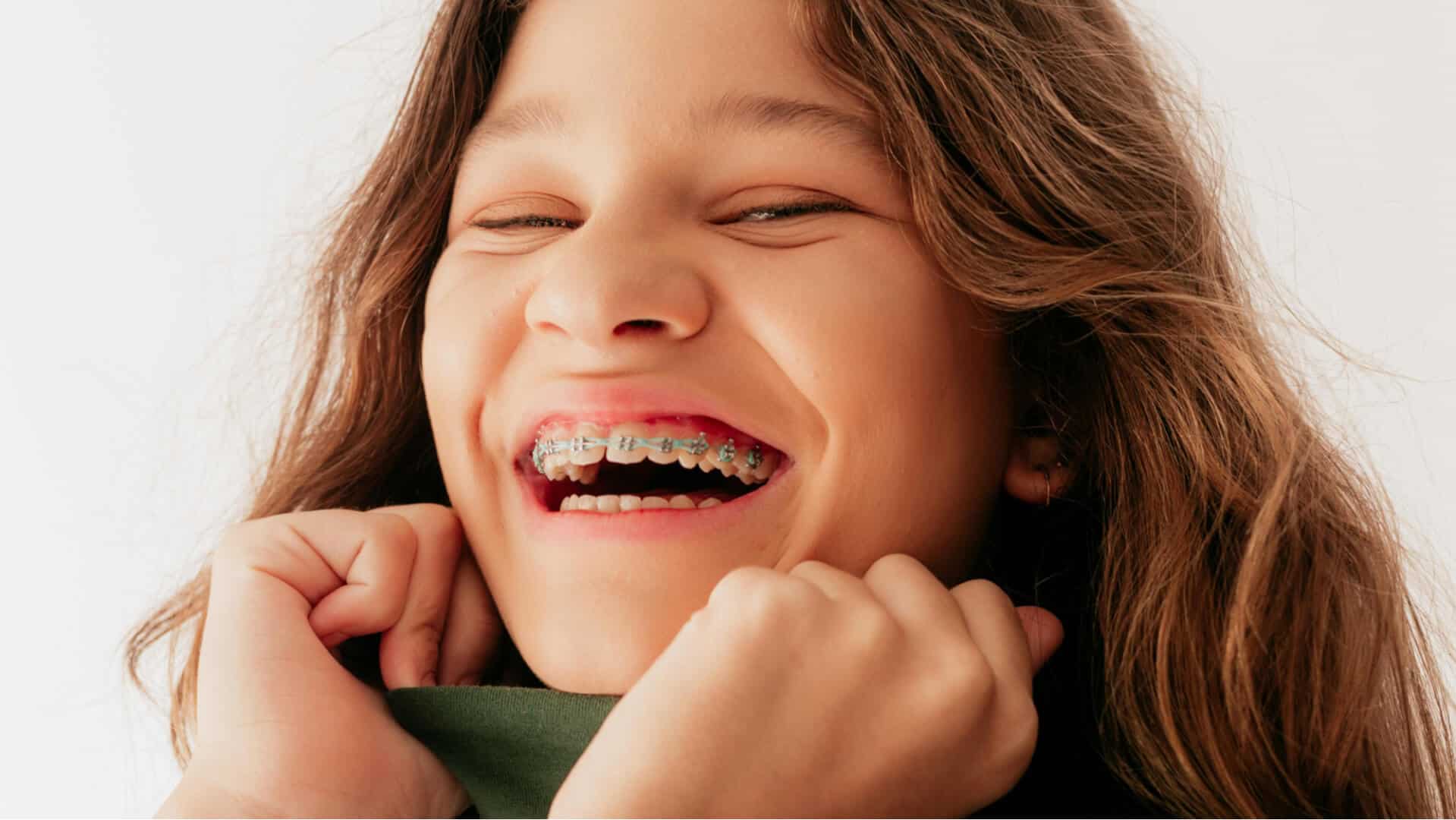 How Long Does It Take to Put on Braces How Long Does It Take to Put on Braces