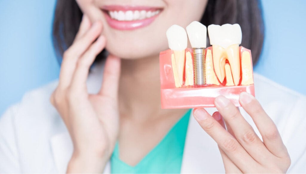 What Are the 3 Types of Dental Implants