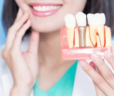 What Are the 3 Types of Dental Implants