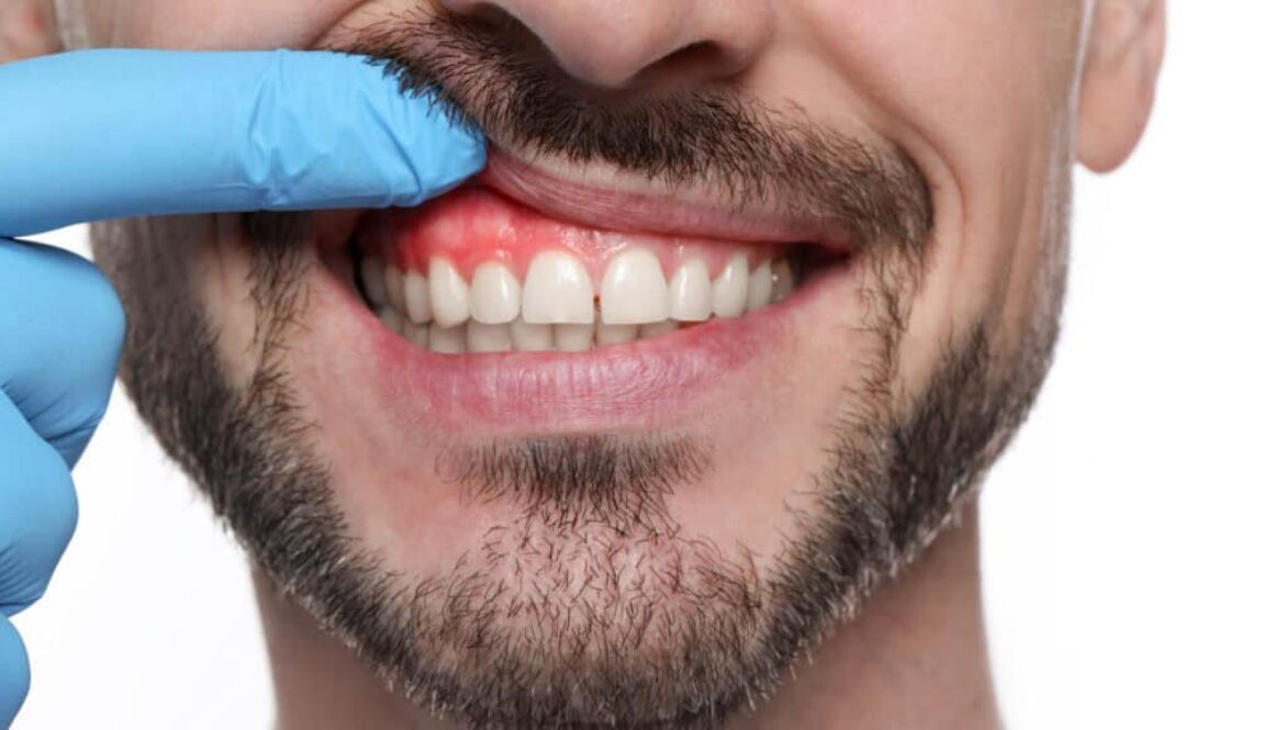 Pale Gums – What They Mean and When to See a Dentist