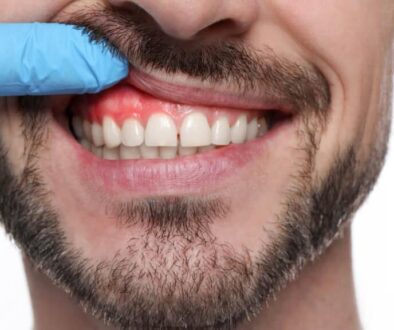 Pale-Gums-What-They-Mean-and-When-to-See-a-Dentist Pale Gums – What They Mean and When to See a Dentist