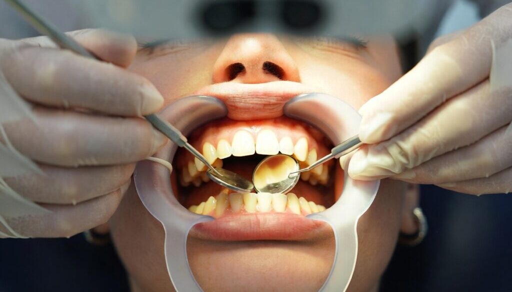Best Teeth Whitening Options in London Explained