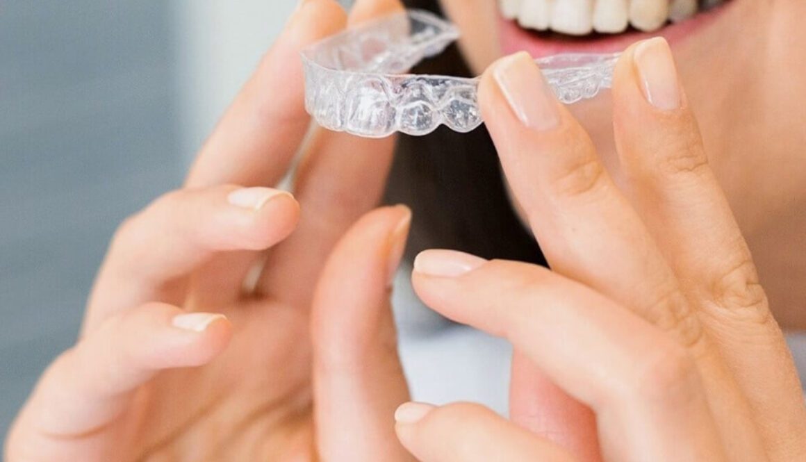Is Invisalign Worth It? Costs and Benefits Explained