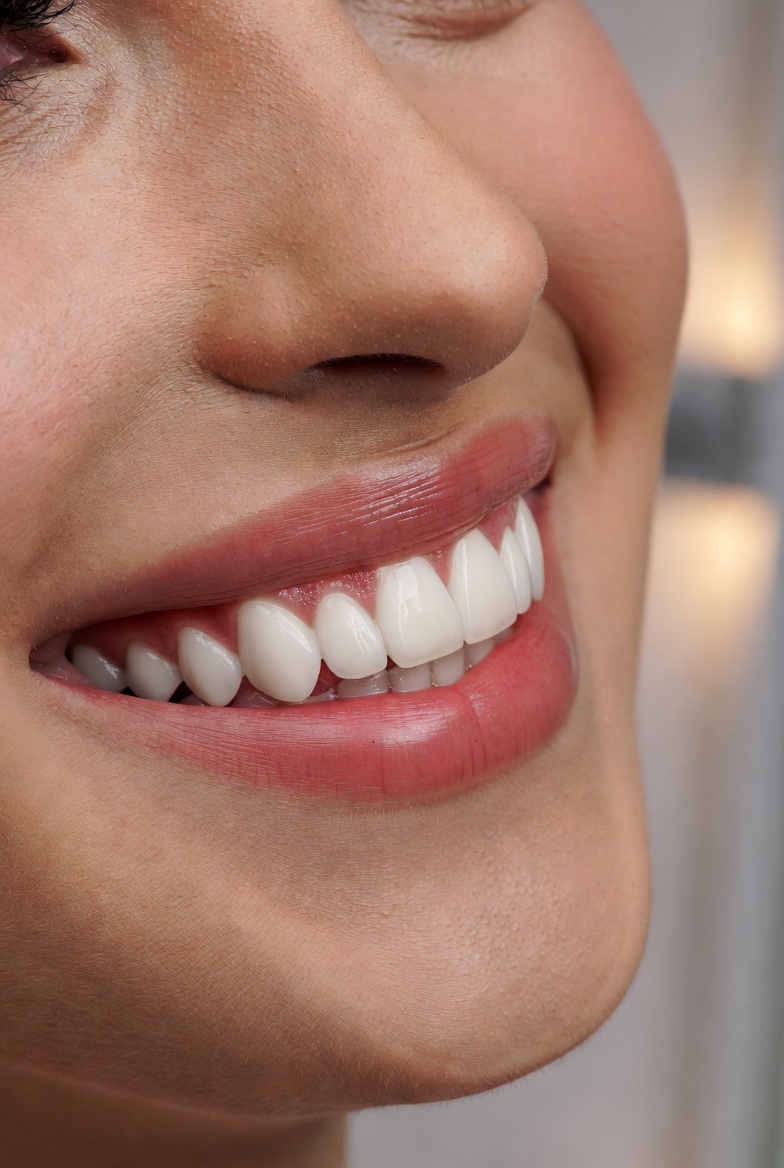 Is Composite Bonding Suitable for Me?